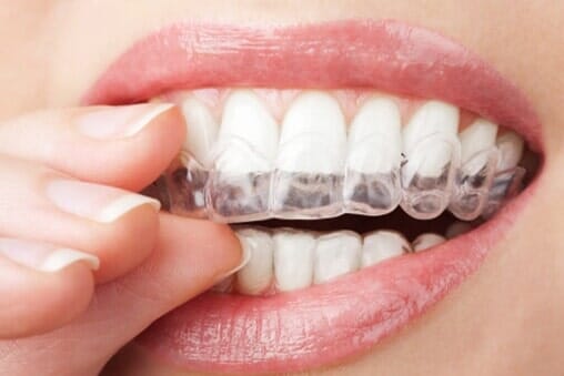 Image result for Dental Care