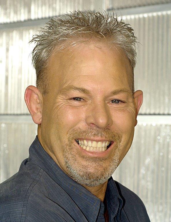 Hair Loss Images Spokane Valley, WA Apollo Hair Center