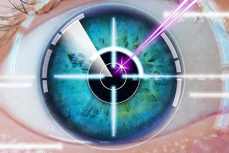 laser eye surgery in macomb county, michigan