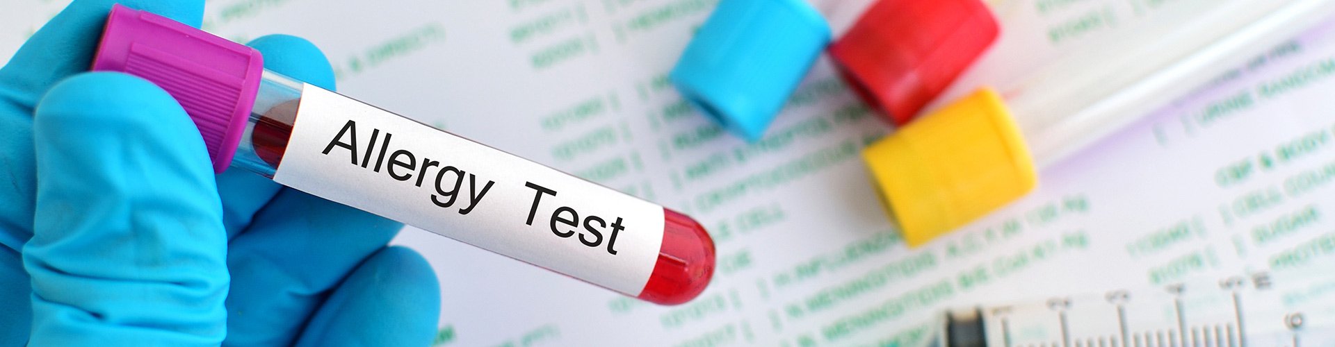 Allergic Conditions Treated Haden Allergy and Asthma Clinic of Fort Worth