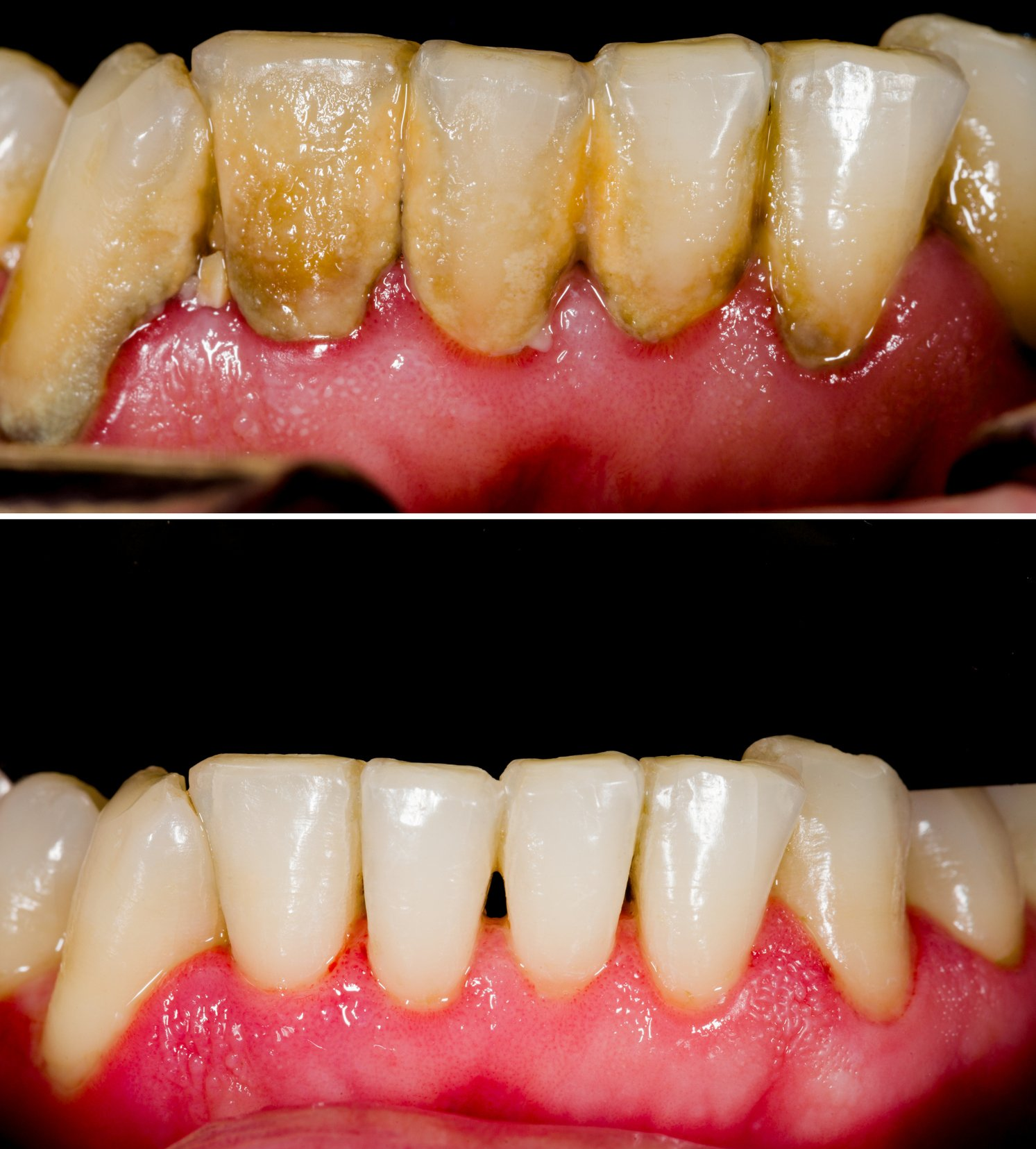 Periodontal Maintenance Memphis, TN Dynamic Dental Smiles of Midtown