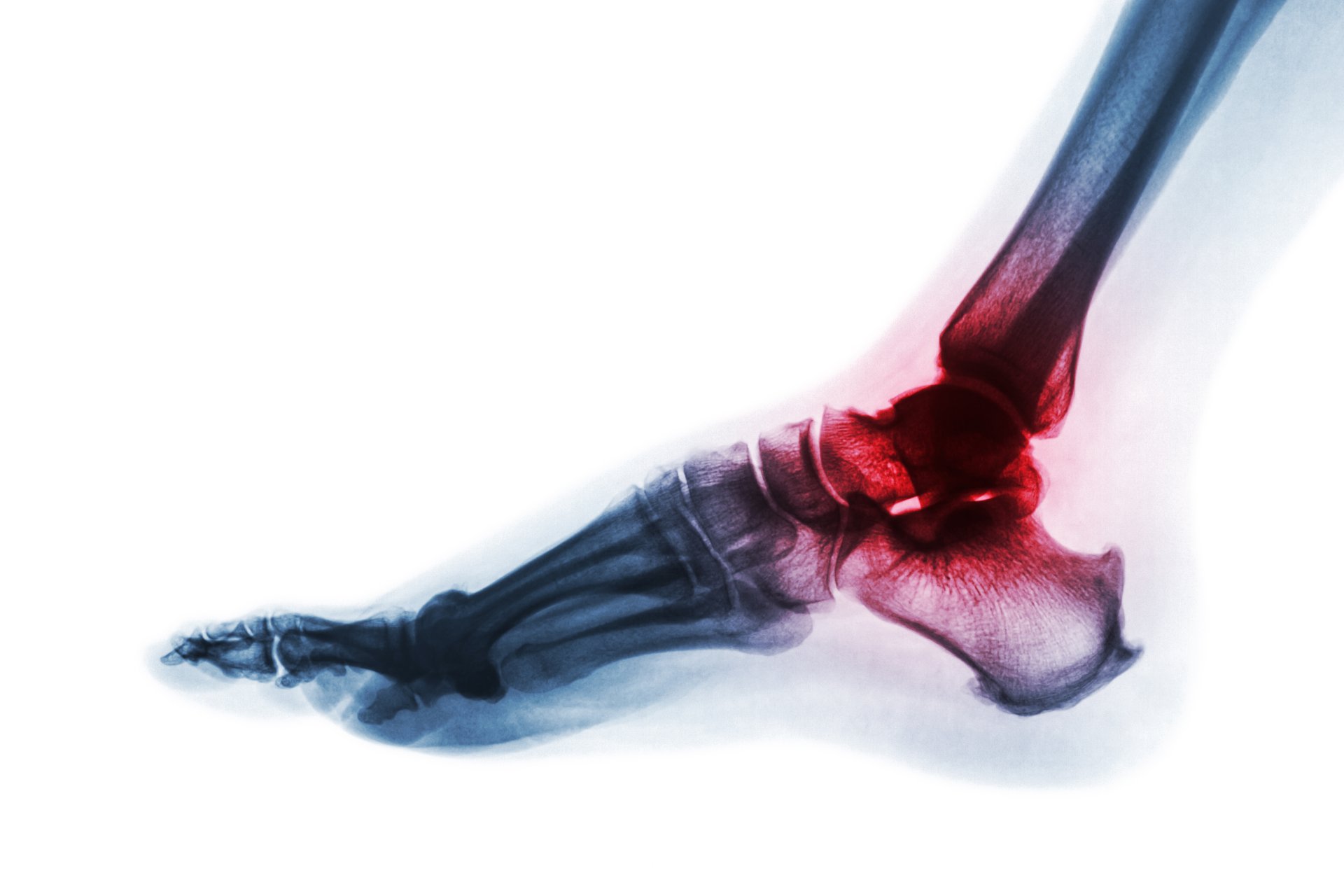 Orthopedic Surgeries & Specialties Naples, FL Naples Orthopedics