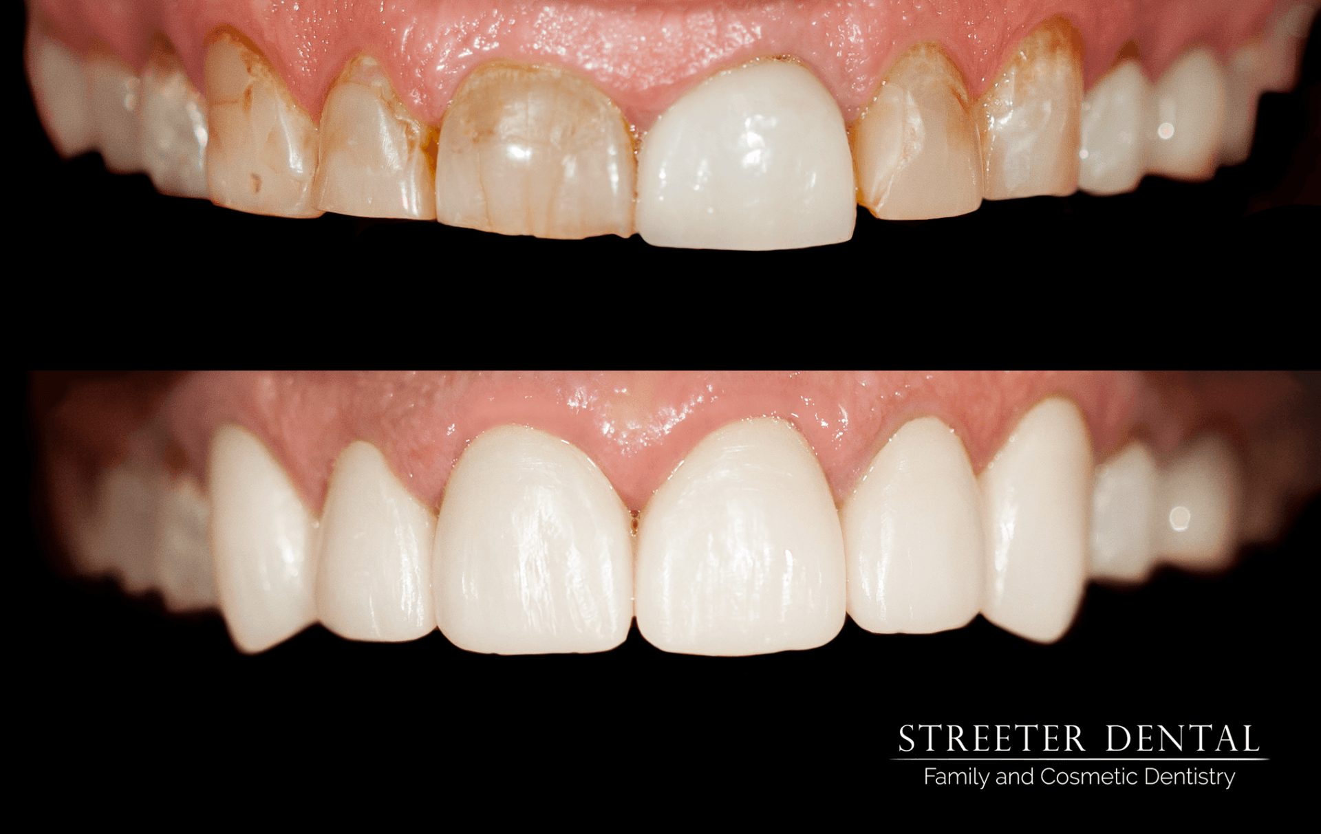 Dental Treatments Colorado Springs, CO Streeter Dental