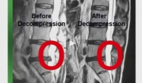 Massage Treatments - Colorado Springs, CO - Complete Chiropractic