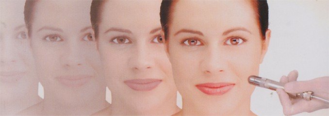 Hair Removal Systems Colonial Heights Va