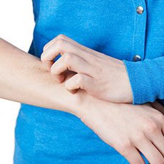Health Management — Woman Scratching Arm in Nashville, TN