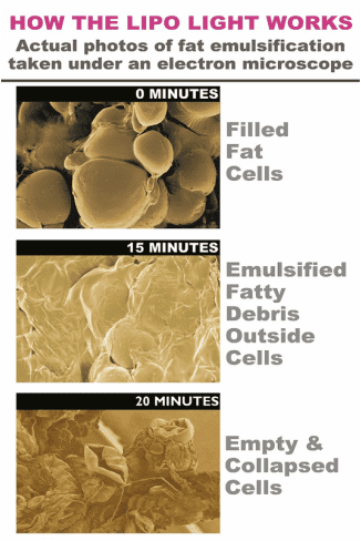Sunless Tanning | Cheektowaga, NY | Extreme Sun Capsule | Buffalo, NY