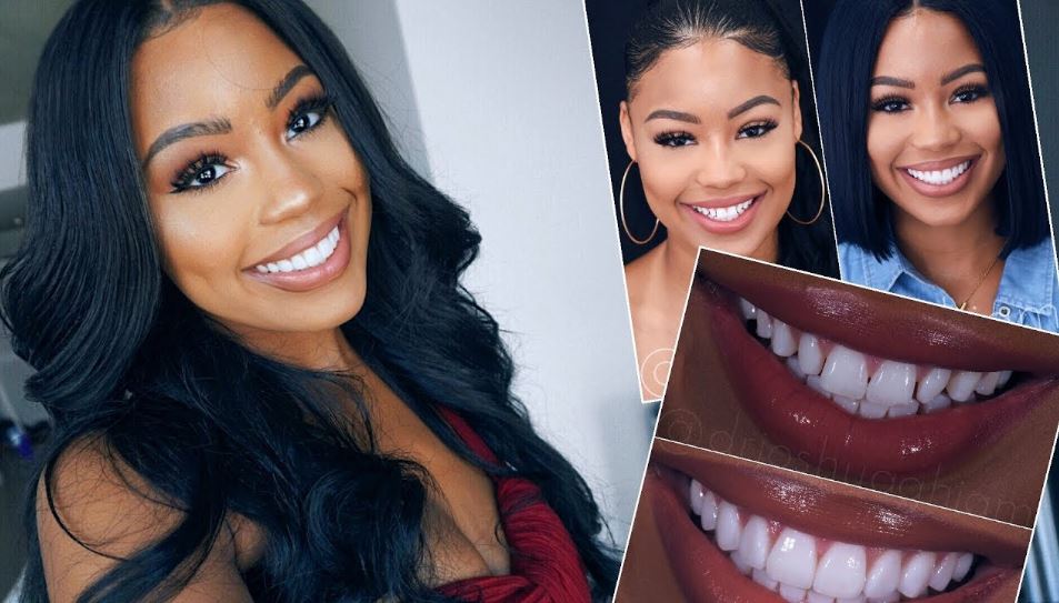 Porcelain Veneers, Crowns, and Implant Restorations Tampa, FL The