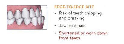 Invisalign Orthodontics - Tampa, FL - The Hyde Park Center For ...