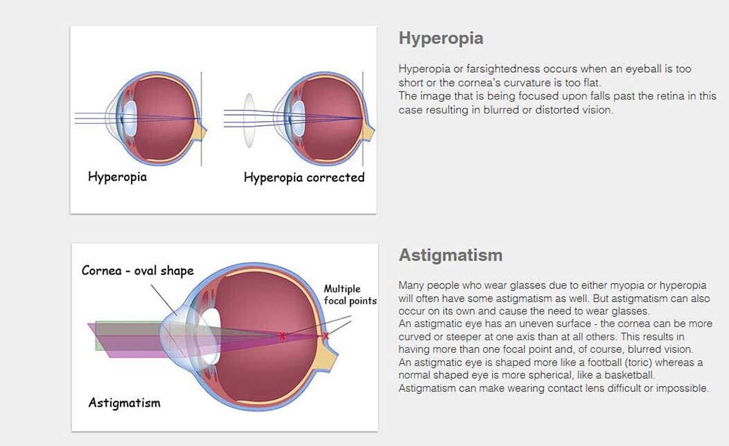 eye care services barrington lake zurich il the eye works ltd eye works lake zurich