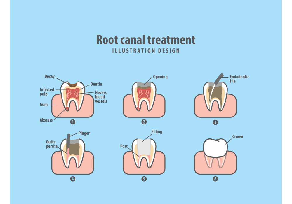 Endodontic Services Richmond, VA Dr. Oley, Shaia & Associates