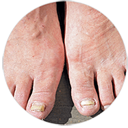 Dermatology — Idaho Falls — Idaho Falls Dermatology